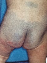 Ayuden librarse de las manchas de pigmento